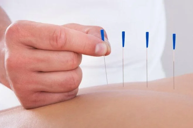 Image of our muscle/soft tissue release, a chiropractic technique