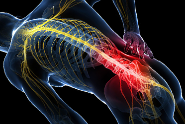 Nerve Pain Treatment